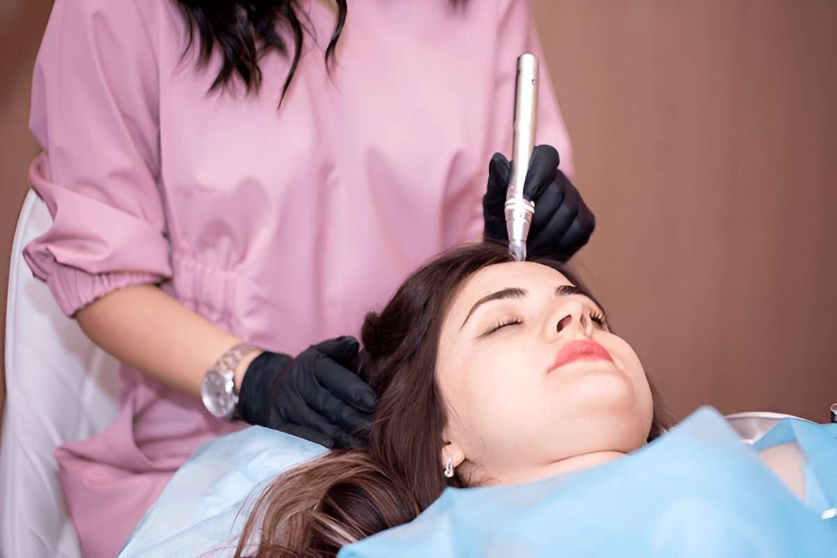 manual hair transplant