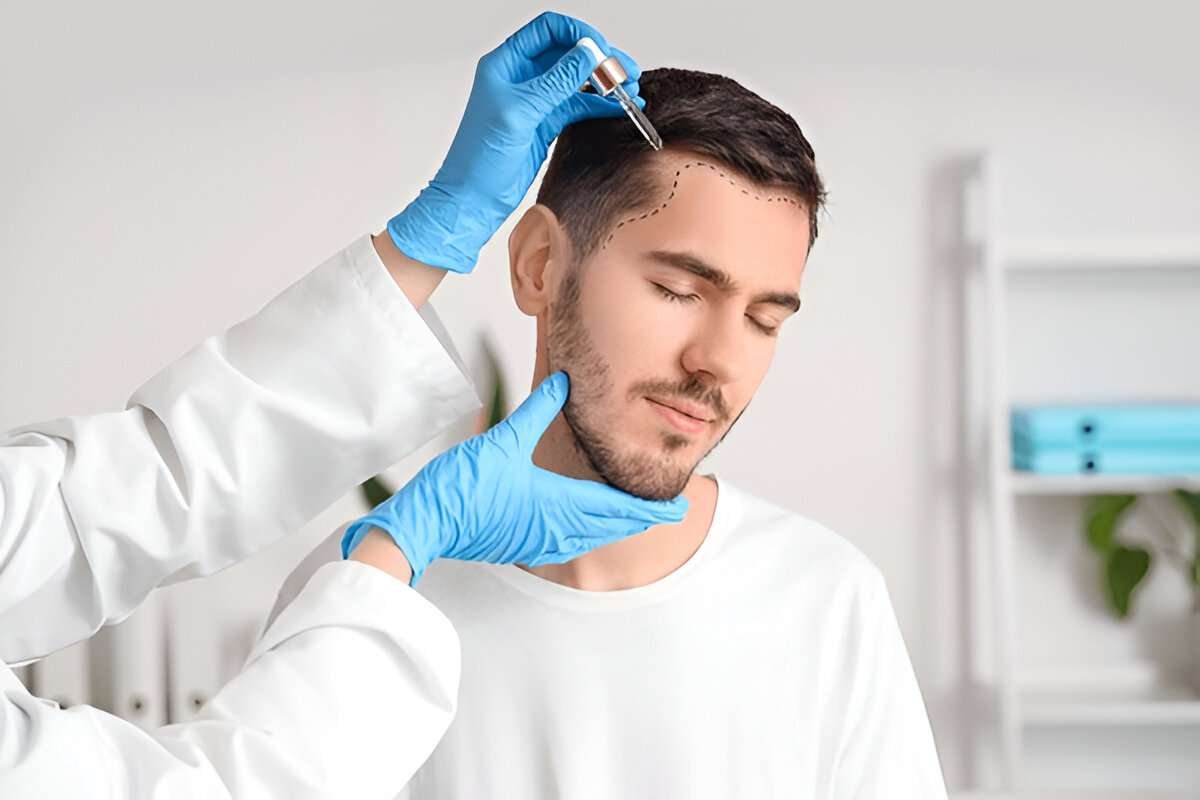 hair transplant Bristol