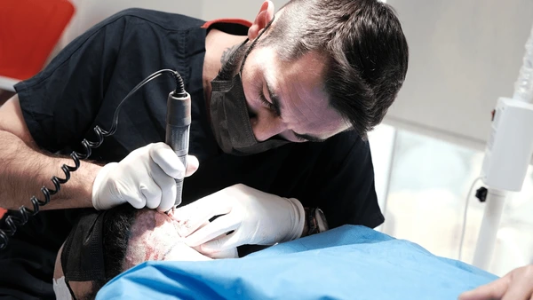 Hair Transplant