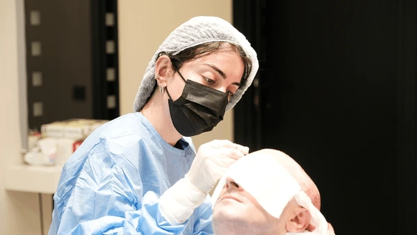 hair transplant